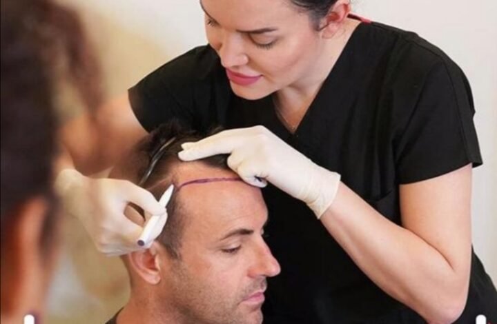 مركز Estepera واحدث تقنيات زراعة الشعر العالمية 1 e71b76df2bce6b29dba5fe26a3e83726
