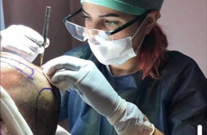 زراعة الشعر بدون حلاقة حصرياً في مركز Estepera 1 e7686ef124e21f65487feff30fcd93f9