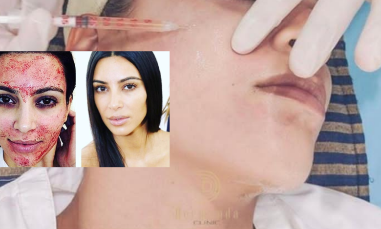  Dermand Clinic تقدم تقنية الـ"PRP" بجودة عالية واهتمامٍ لا مثيل له 1 78f41efb9621fbbd085d733fe253d135