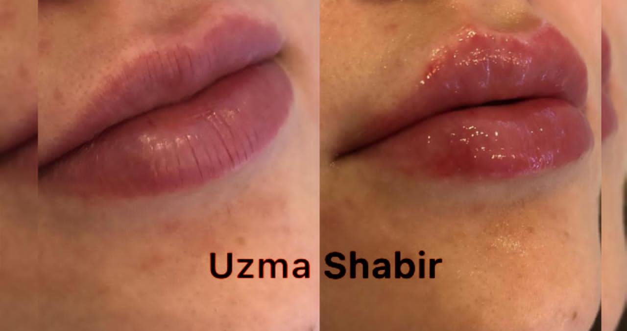 خبيرة التجميل عظمي شبير/ Uzma Shbr تشارك المتابعين مجموعة Reels لافتة 3 ca9ba4cbe143acd499c9ed895e7a59fc