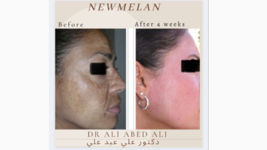دكتور التجميل علي عبد علي يتحدث عن تقنية "Newmelan Pigmentation" 8 be2b4c89438099e8fca78e767ef03dbd