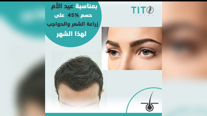 بمناسبة عيد الأم... Tito Center يقدّم عرض خاص على زراعة الشعر و الحواجب 1 1646950090ede1670ecc