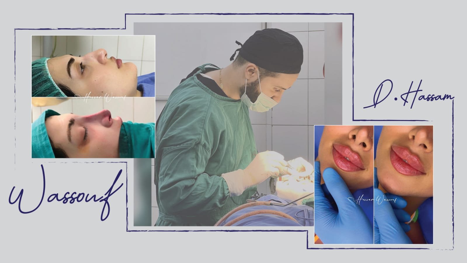 الدكتور حسام الوسوف مرآة للفن في الجراحة التجميلية 3 1657657473d74e6256c3