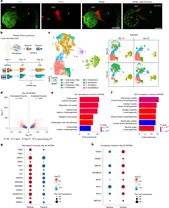 Myocardial reprogramming by HMGN1 underlies heart defects in trisomy 21 3 Myocardial reprogramming by HMGN1 underlies heart defects in trisomy 21