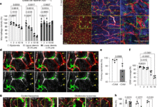 Niche-specific dermal macrophage loss promotes skin capillary ageing