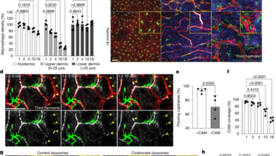 Niche-specific dermal macrophage loss promotes skin capillary ageing