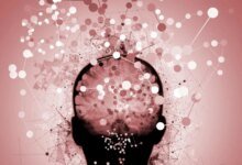 علم الأعصاب رسم خرائط الدماغ الارتباك الخرف