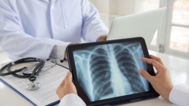 عقار إيراني متطور لعلاج التليف الرئوي
