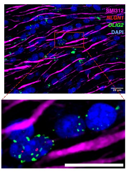 توصلت الدراسة إلى أن تقييد السعرات الحرارية يبطئ شيخوخة الدماغ