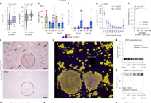 Hepatic zonation determines tumorigenic potential of mutant β-catenin