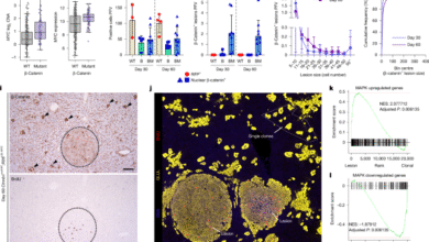 Hepatic zonation determines tumorigenic potential of mutant β-catenin