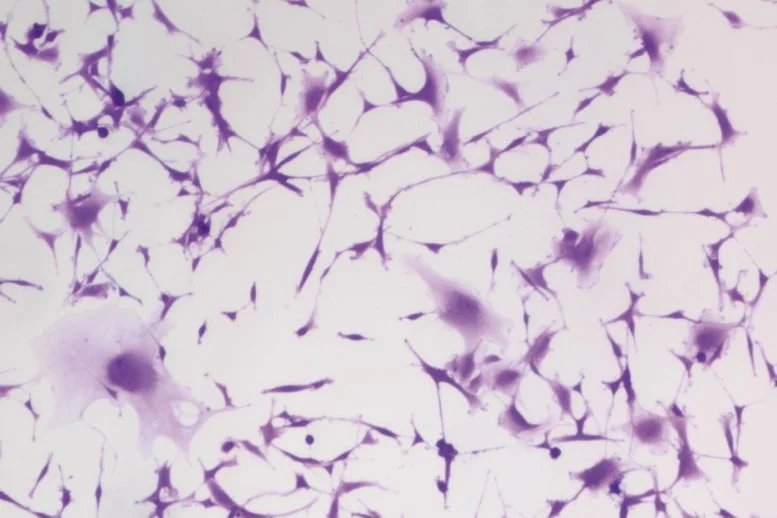 Hydralazine Treated Glioblastoma Cells Showing Senescence