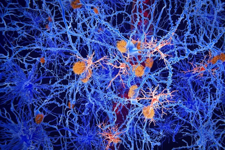 Microglia Cells Brain Neuroscience Alzheimers Disease
