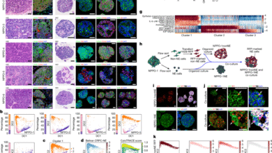 NSD2 targeting reverses plasticity and drug resistance in prostate cancer NSD2 targeting reverses plasticity and drug resistance in prostate cancer