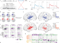 Shared and language-specific phonological processing in the human temporal lobe