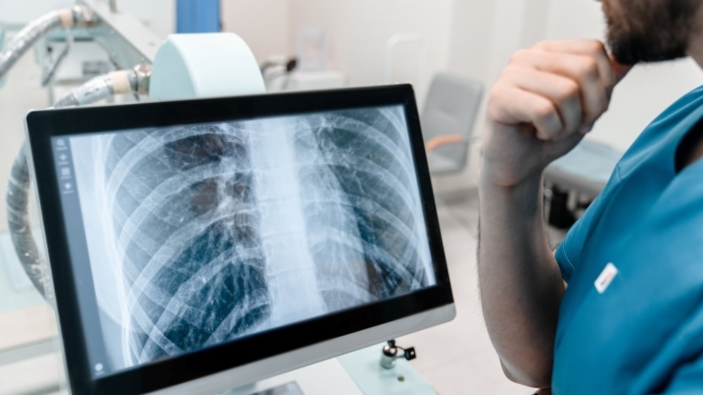 ووصفت منظمة الصحة العالمية العدوى التي تحصد أكبر عدد من الأرواح في العالم