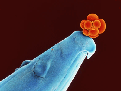 يقول Biotech Barbie إن الوقت قد حان للنظر في أطفال CRISPR. هل يتفق العلماء؟ 2 d41586 025 03554 y 25886506