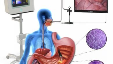 جهاز للكشف المبكر عن أورام الجهاز الهضمي