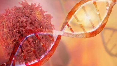 حبلا الحمض النووي وأورام الخلايا السرطانية