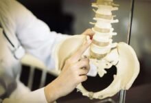 خطوة إيرانية رائدة في علاج ضمور العضلات الشوكي