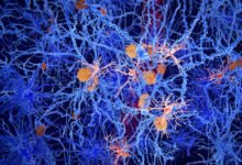 خلايا المخ المخفية قد تحمل مفتاح مرض الزهايمر