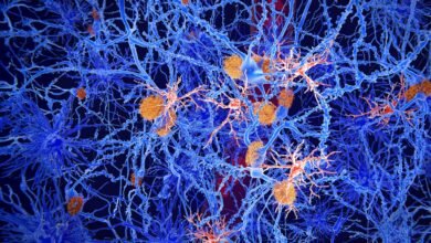 خلايا المخ المخفية قد تحمل مفتاح مرض الزهايمر