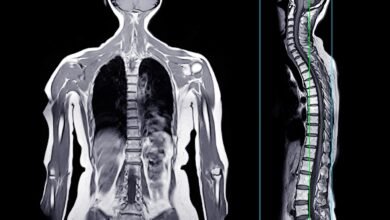 رجل يتمتع بصحة جيدة يبلغ من العمر 47 عامًا يأكل هامبرغر. وبعد ساعات، كان ميتا