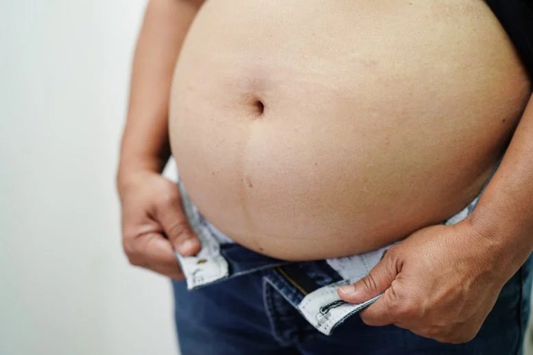 يحذر الخبراء من أن علاج السمنة أصبح نظامًا من مستويين.