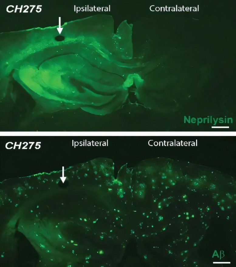 CH275 Effects on Neprilysin and Amyloid