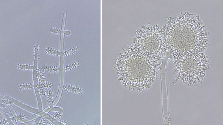 اكتشف العلماء أن الفطريات المرتبطة بالنمل هي أكثر بكثير من مجرد شريرة 2 Cylindrical Vesicles of the Species Escovopsis weberi