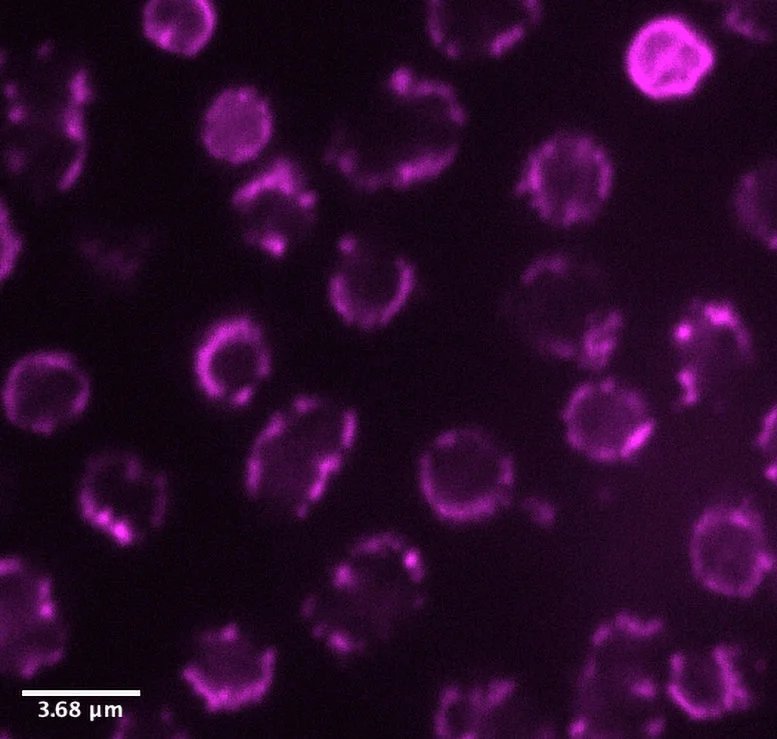 اكتشف العلماء كائنًا حيًا يكسر القاعدة الذهبية لعلم الأحياء 2 Methanogens