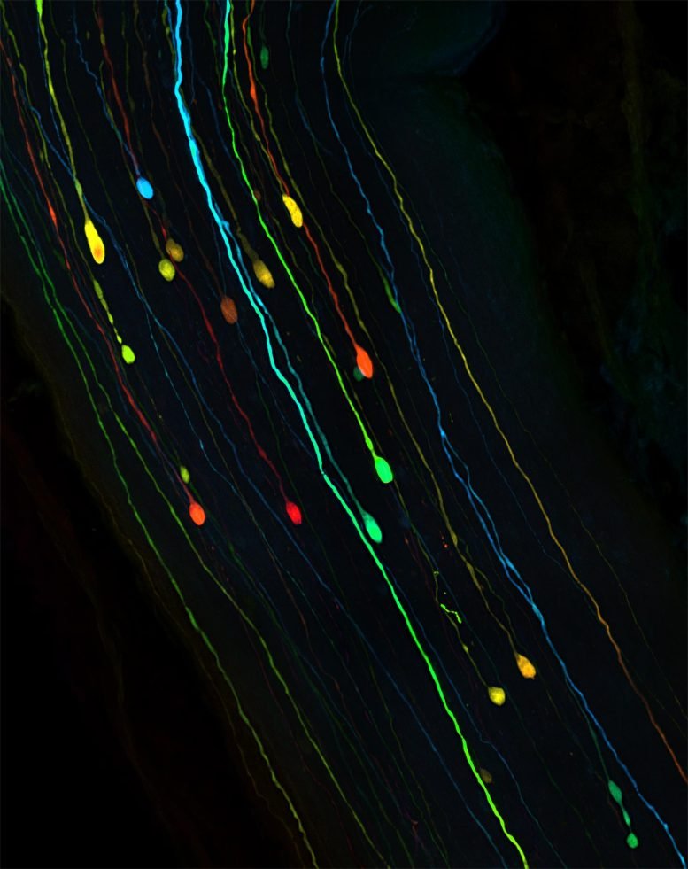 تساعد خدعة إصلاح الدماغ المخفية على استعادة الرؤية بعد الصدمة 2 Neurons After Traumatic Brain Injury