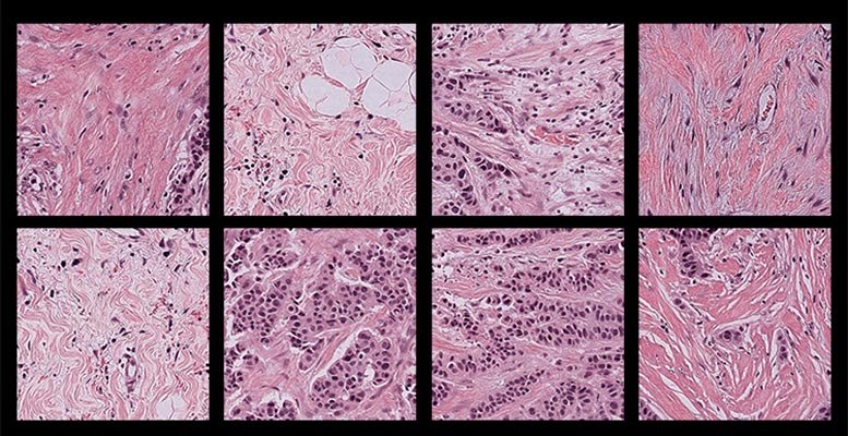 ما تعلمه الذكاء الاصطناعي من شرائح السرطان صدم الباحثين 2 Pathology Human Tissue Samples