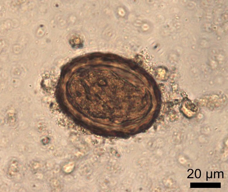 Roundworm Egg