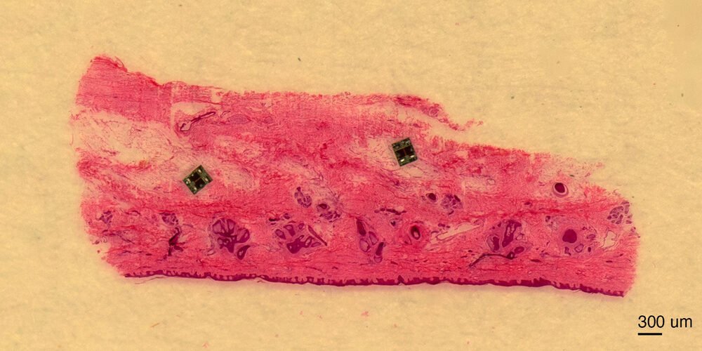 ابتكر المهندسون الحيويون أصغر روبوتات مستقلة في العالم 3 b32b55ad991e0dbd8936619913fbdb1a278feaa8