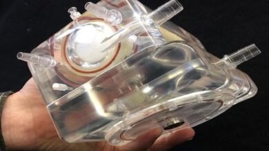 إنجاز إيراني في إنتاج نموذج أولي مختبري للرئة الاصطناعية