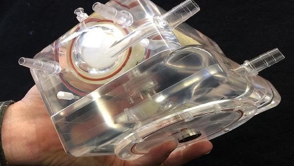 إنجاز إيراني في إنتاج نموذج أولي مختبري للرئة الاصطناعية