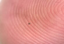 ابتكر المهندسون الحيويون أصغر روبوتات مستقلة في العالم