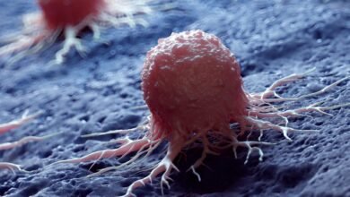 تعمل النقاط النانوية المعدنية الصغيرة على القضاء على الخلايا السرطانية مع الحفاظ على الأنسجة السليمة إلى حد كبير