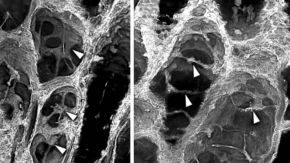 حفرية عمرها 407 ملايين سنة تكشف كيف أصبحت النباتات عمالقة