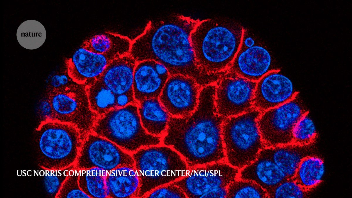 ستة نقاط بارزة من أبحاث سرطان البنكرياس ستة نقاط بارزة من أبحاث سرطان البنكرياس