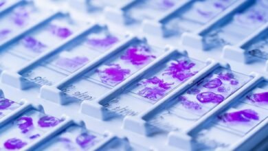 ما تعلمه الذكاء الاصطناعي من شرائح السرطان صدم الباحثين ما تعلمه الذكاء الاصطناعي من شرائح السرطان صدم الباحثين