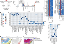Bidirectional CRISPR screens decode a GLIS3-dependent fibrotic cell circuit