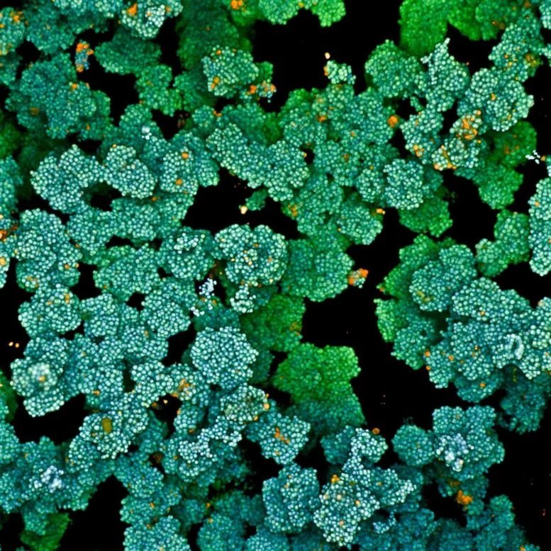 Microbial Biofilm Microscopy