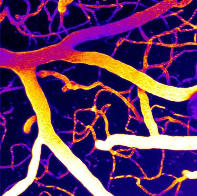 Microvasculature of a Brain