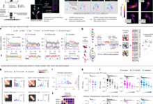Mimicking opioid analgesia in cortical pain circuits