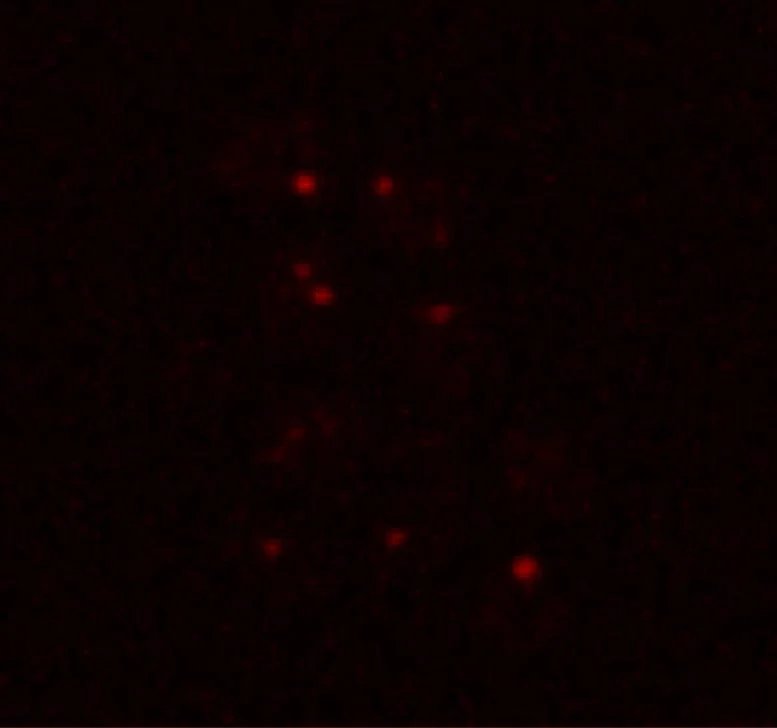 Ribonucleoprotein Condensates Forming Under Mars Like Stress