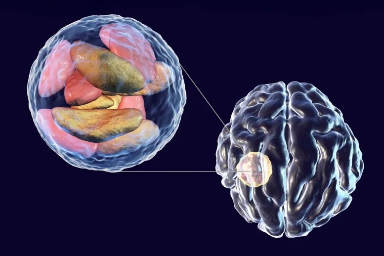 Toxoplasma gondii Brain