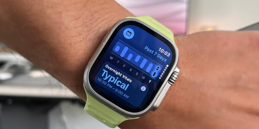 watchOS 11 FI