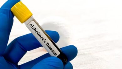 اختبارات الدم تكشف مدى سرعة السمنة في تسريع مرض الزهايمر